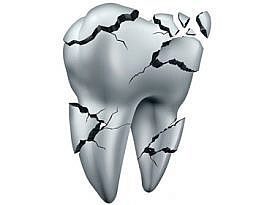 Accident dentar