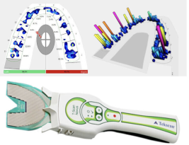Ocluzia dentară corecta
